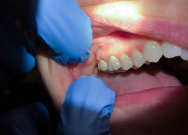Best Same-Day Emergency Dental Services in Johns Creek, GA