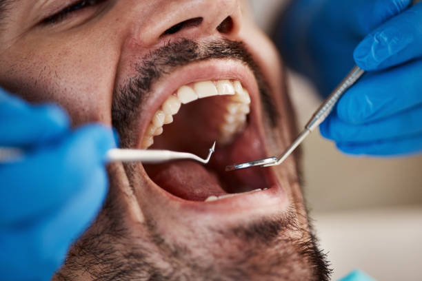 Best Emergency Gum Treatment in Johns Creek, GA