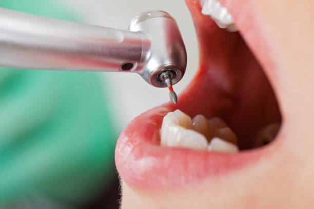 Best After-Hours Dental Trauma Care in Johns Creek, GA